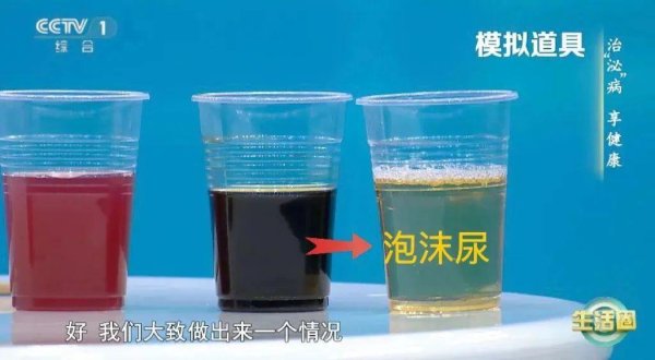 永信证券 健康 | 喝水后4个异常，可能是肾发出的“求救信号”！